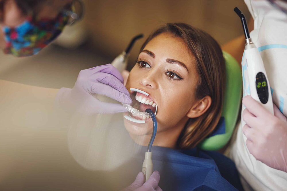 Dental Bonding Canton